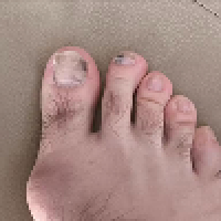 Array image
